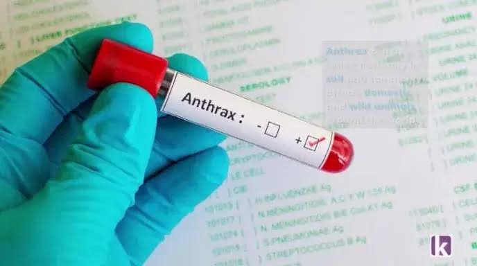 Anthrax Outbreak Hits Zamfara: FG Warns Nigerians to Take Precautions 1 images (1)