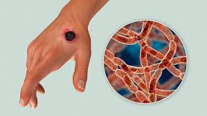 Anthrax Outbreak Hits Zamfara: FG Warns Nigerians to Take Precautions 2 images 4 3