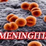 Meningitis Outbreak: 807 Cases, 74 Deaths Reported Across 22 States