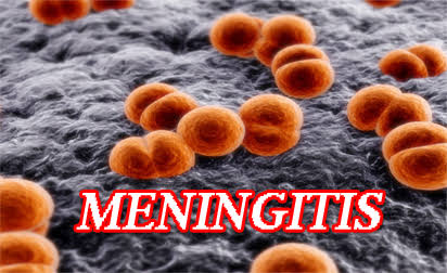 Meningitis Outbreak: 807 Cases, 74 Deaths Reported Across 22 States